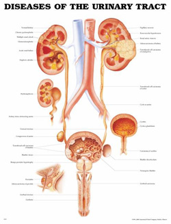 diseases_of_urinary_tract