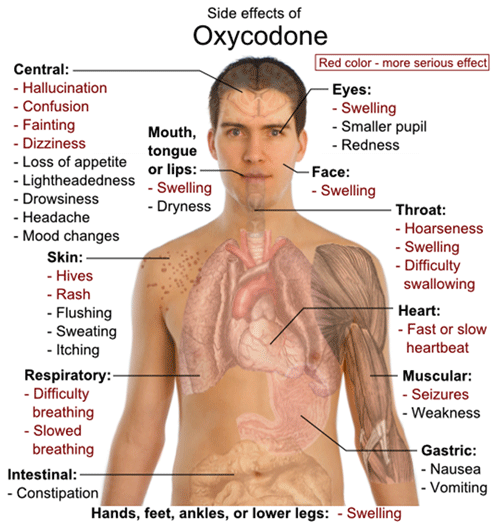 oxycodone-side-effects-500